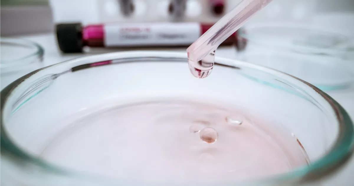 ICSI in Österreich: Ablauf, Erfolgschancen, Kosten & rechtliche Infos